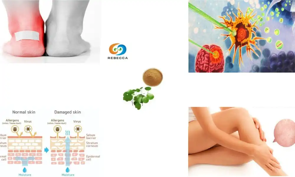 How does centella asiatica aid in wound healing and skin repair?